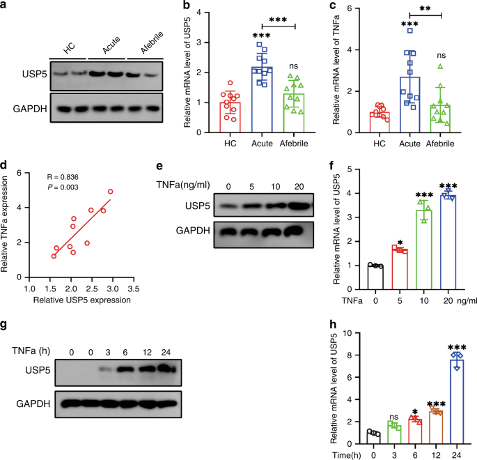 Kawasaki disease: ubiquitin-specific protease 5 promotes endothelial inflammation via TNFα-mediated signaling