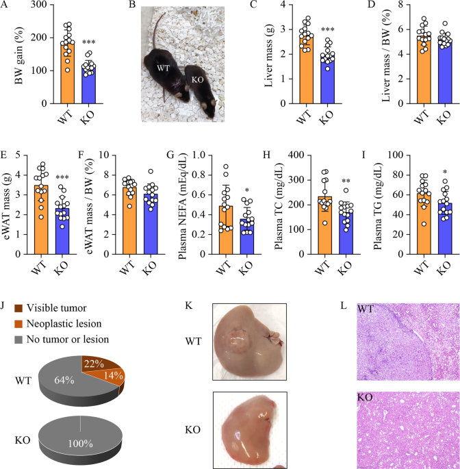 Ablation of sphingosine kinase 2 suppresses fatty liver-associated hepatocellular carcinoma via downregulation of ceramide transfer protein