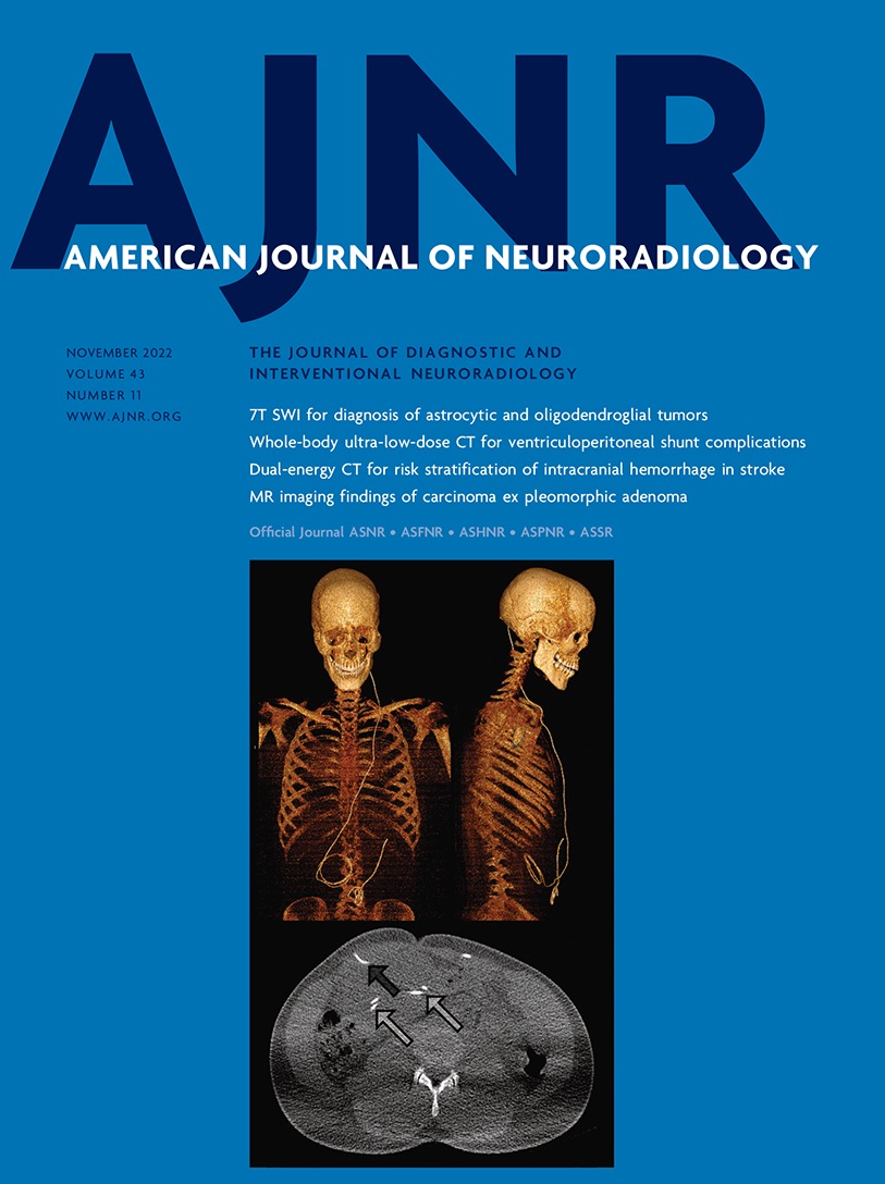 Neuroimaging in Pediatric Patients with Juvenile Xanthogranuloma of the CNS [PEDIATRICS]