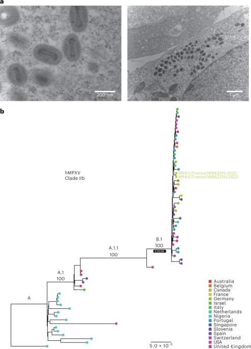 Tecovirimat is effective against human monkeypox virus in vitro at nanomolar concentrations