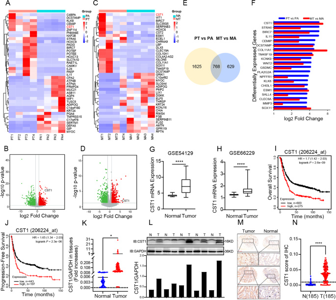 CST1 inhibits ferroptosis and promotes gastric cancer metastasis by regulating GPX4 protein stability via OTUB1