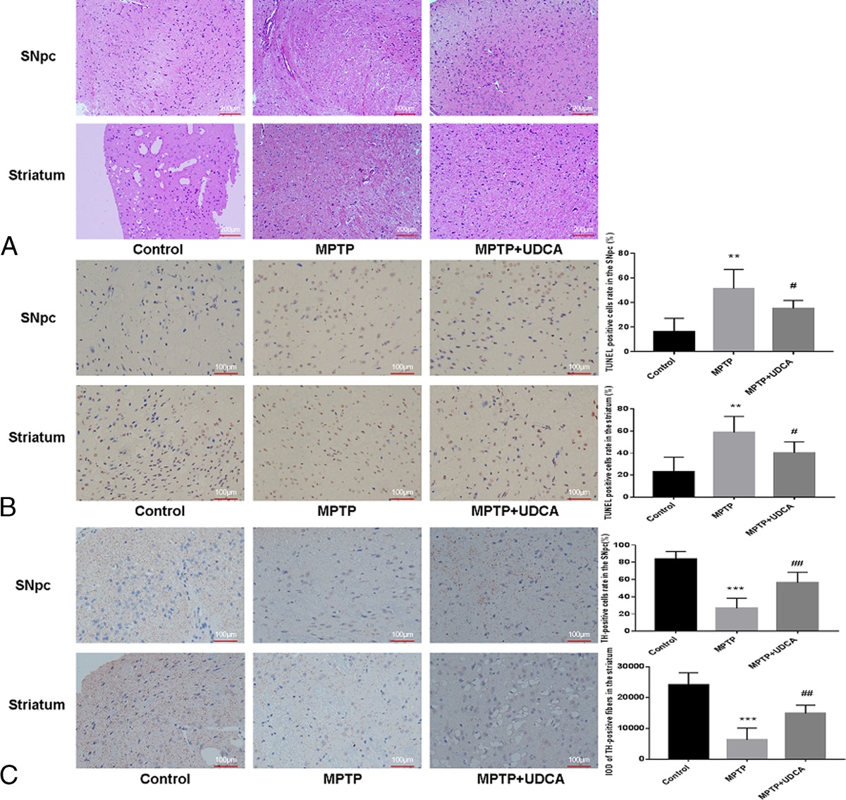 Protective Effects of Ursodeoxycholic Acid Against Oxidative Stress and Neuroinflammation Through Mitogen-Activated Protein Kinases Pathway in MPTP-Induced Parkinson Disease