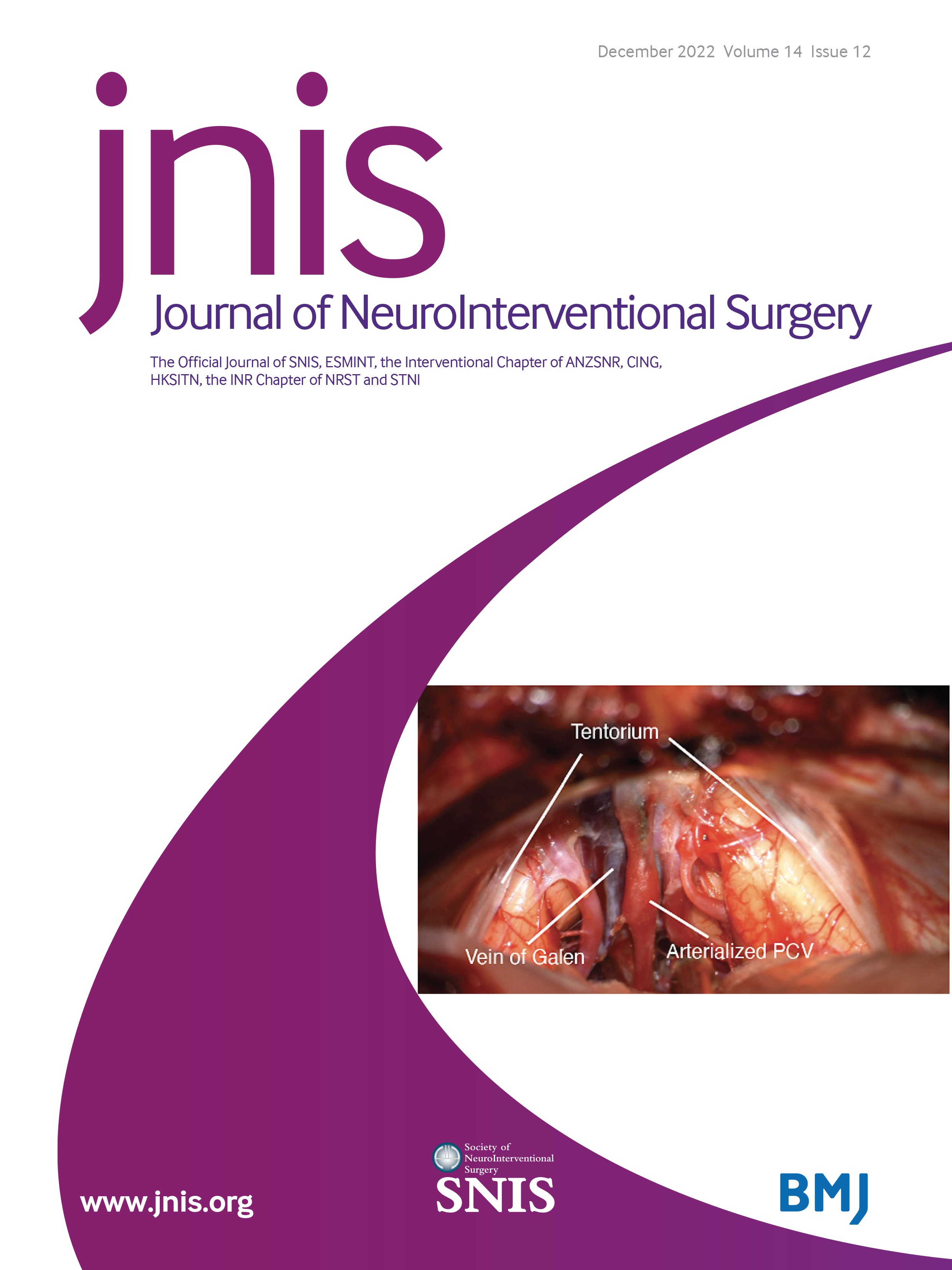 Robotic-assisted intracranial aneurysm treatment: 1 year follow-up imaging and clinical outcomes