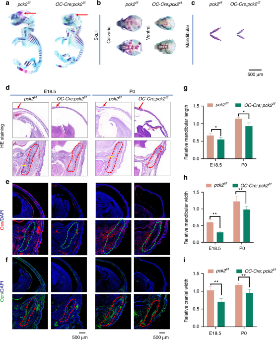 Metformin can mitigate skeletal dysplasia caused by Pck2 deficiency