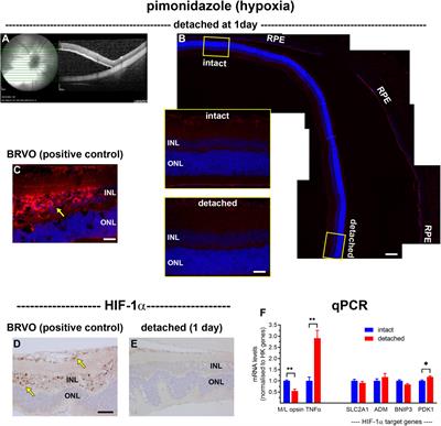 Investigations into photoreceptor energy metabolism during experimental retinal detachment
