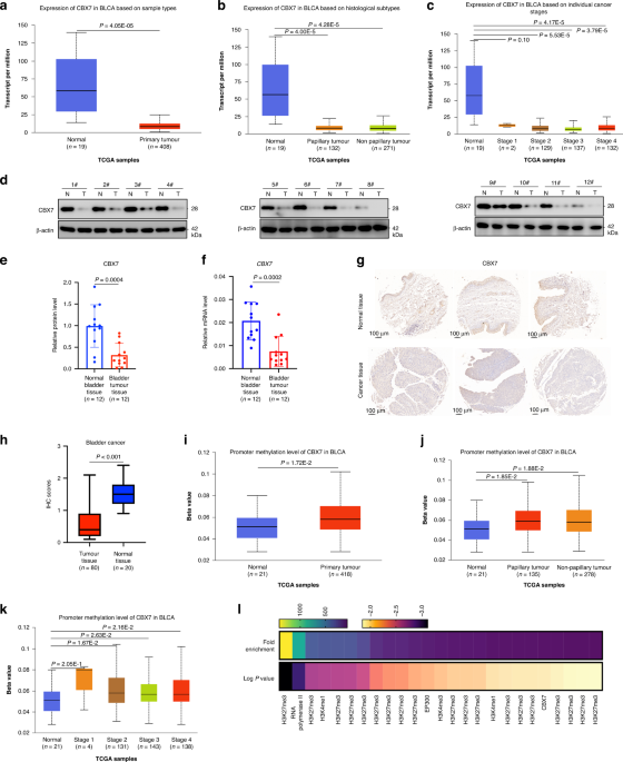 Downregulation of CBX7 induced by EZH2 upregulates FGFR3 expression to reduce sensitivity to cisplatin in bladder cancer