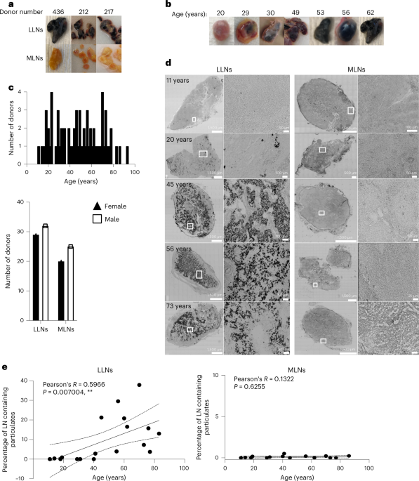Inhaled particulate accumulation with age impairs immune function and architecture in human lung lymph nodes