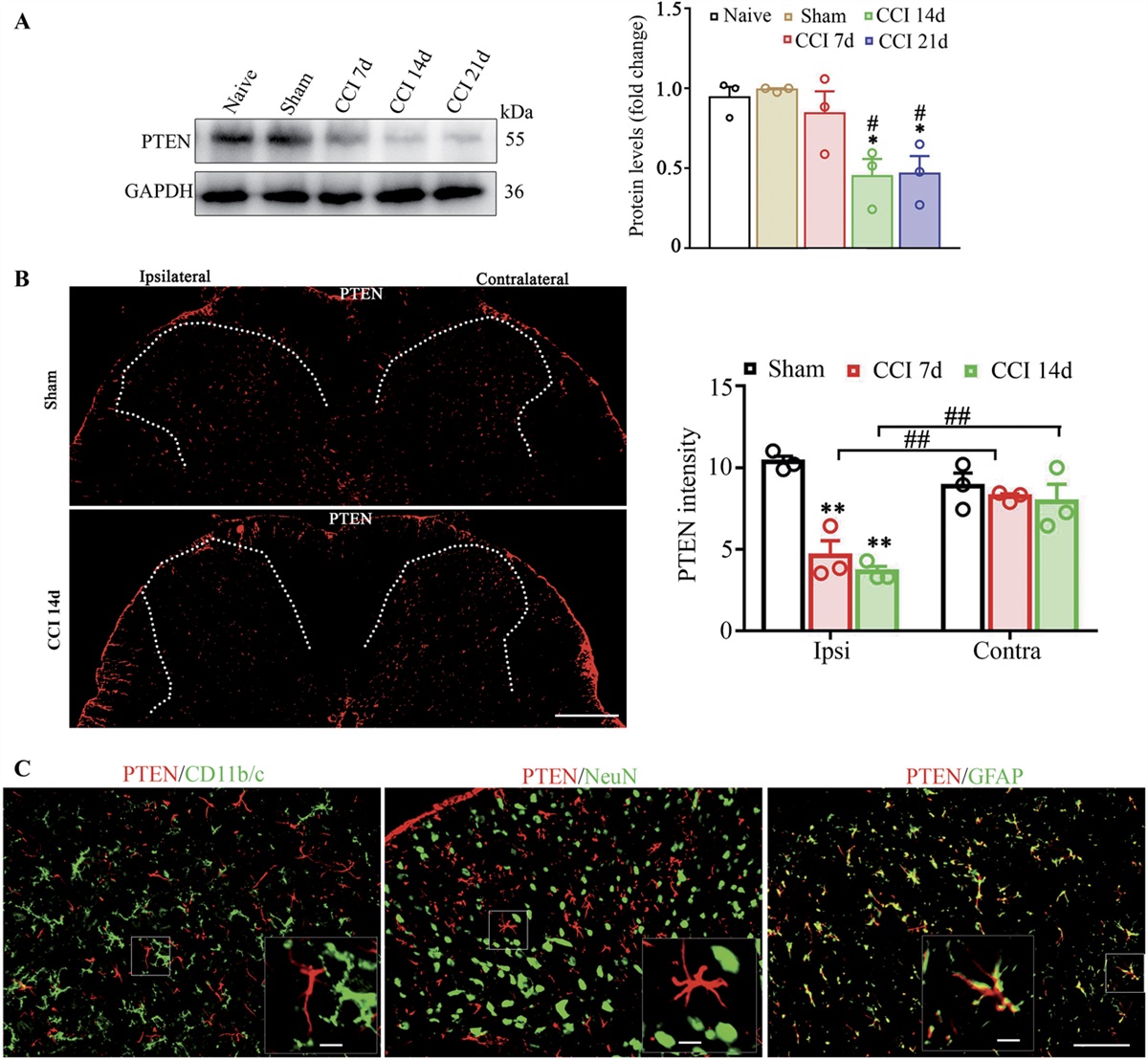 Astrocytic phosphatase and tensin homolog deleted on chromosome 10 regulates neuropathic pain by facilitating 3-hydroxy-3-methylglutaryl-CoA reductase–dependent cholesterol biosynthesis