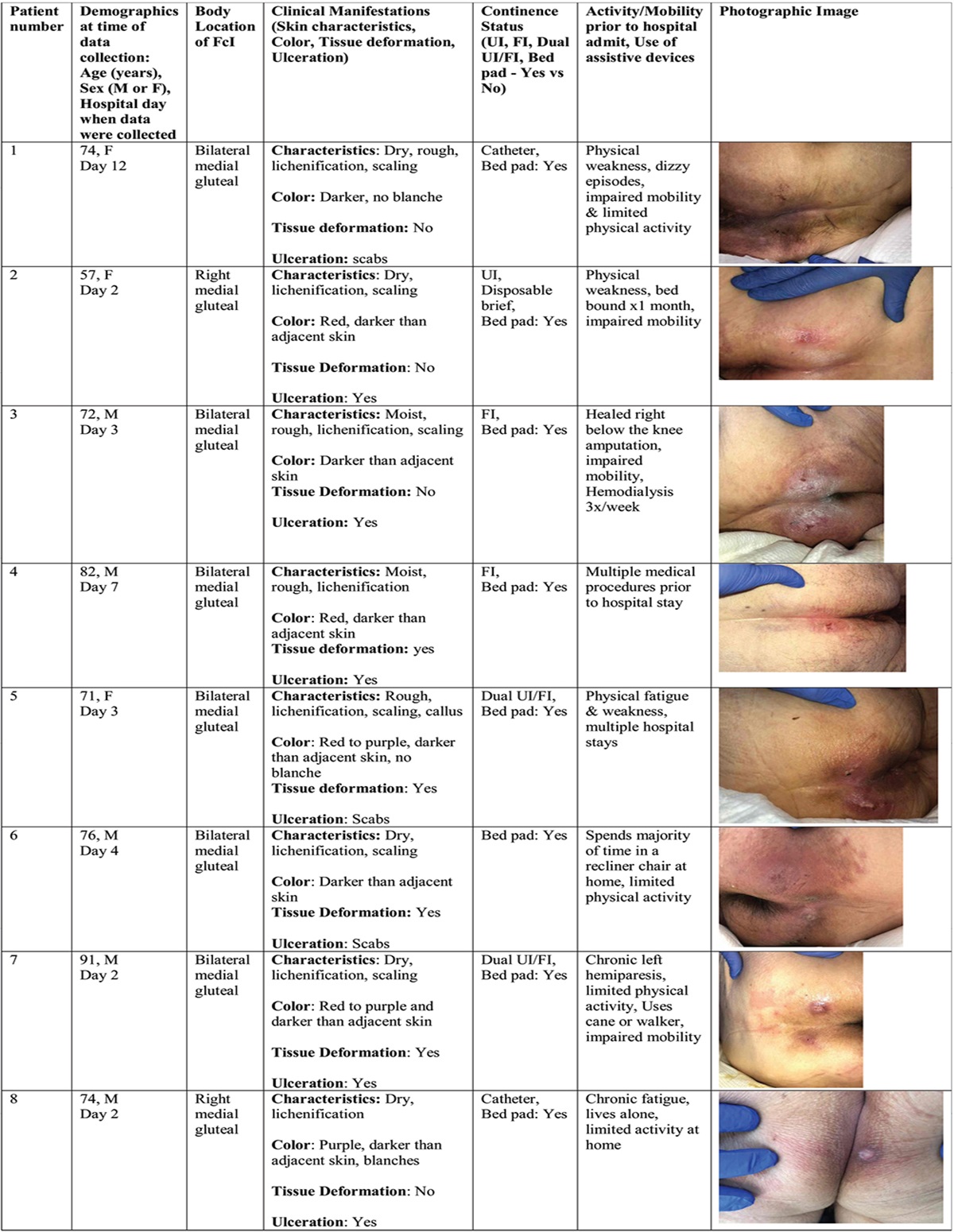 Prevalence of Friction Skin Injury on the Buttocks and/or Posterior Thighs in an Acute Care Setting: A Quality Improvement Project