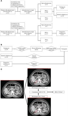 A nomogram for evaluation and analysis of difficulty in retroperitoneal laparoscopic adrenalectomy: A single-center study with prospective validation using LASSO-logistic regression