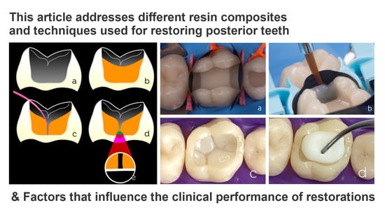 Dentistry Journal, Vol. 10, Pages 222: Resin Composites in Posterior Teeth: Clinical Performance and Direct Restorative Techniques