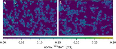The copper transporter CTR1 and cisplatin accumulation at the single-cell level by LA-ICP-TOFMS