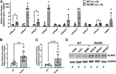 Caspase-1 and the inflammasome promote polycystic kidney disease progression