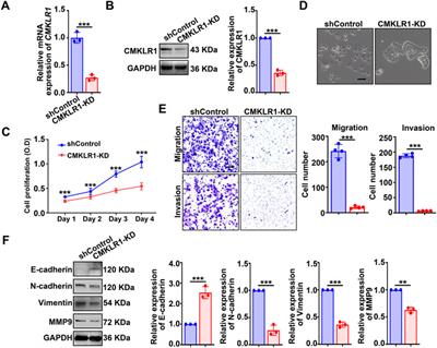 Targeting the chemerin/CMKLR1 axis by small molecule antagonist α-NETA mitigates endometriosis progression