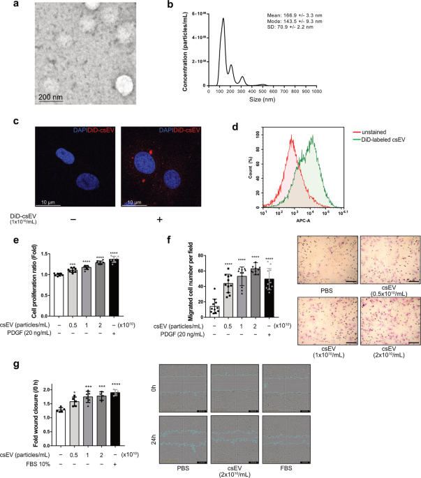Circulating small extracellular vesicles promote proliferation and migration of vascular smooth muscle cells via AXL and MerTK activation