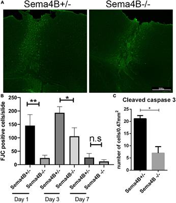 Improved neuron protection following cortical injury in the absence of Semaphorin4B