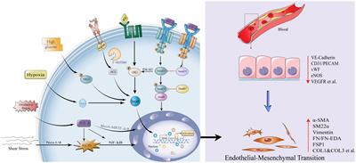 Histone modification of endothelial-mesenchymal transition in cardiovascular diseases