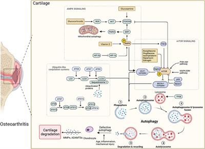 New insights into the interplay between autophagy and cartilage degeneration in osteoarthritis