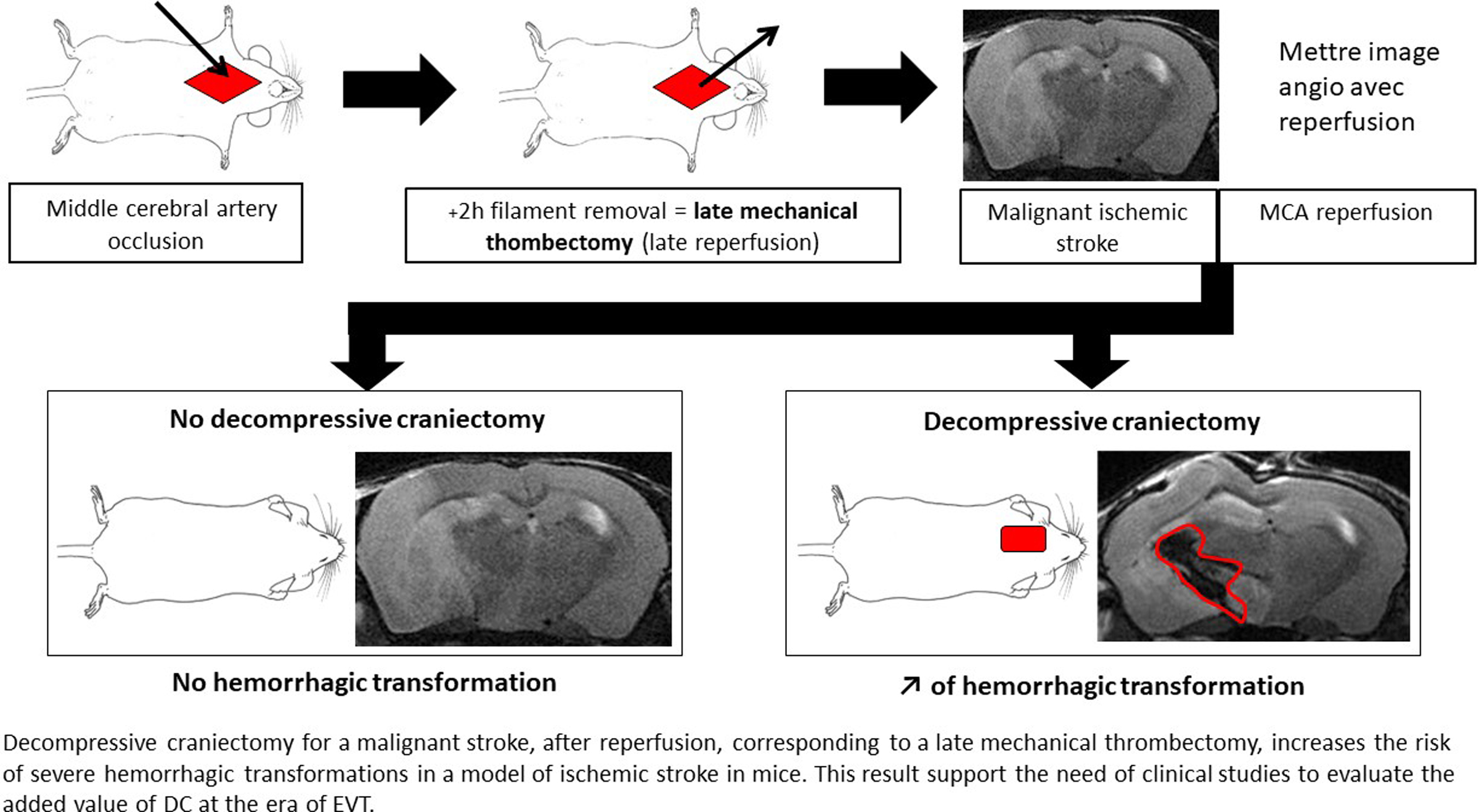 Impact of Decompressive Craniectomy on Hemorrhagic Transformation in Malignant Ischemic Stroke in Mice