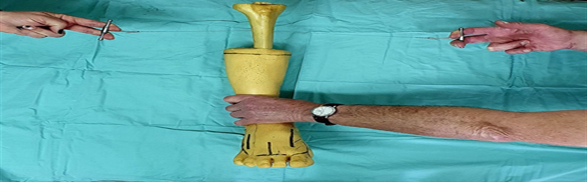The Gigli Saw Osteotomy: A One-Man or Two-Man Technique?