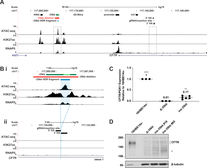 An ectopic enhancer restores CFTR expression through de novo chromatin looping