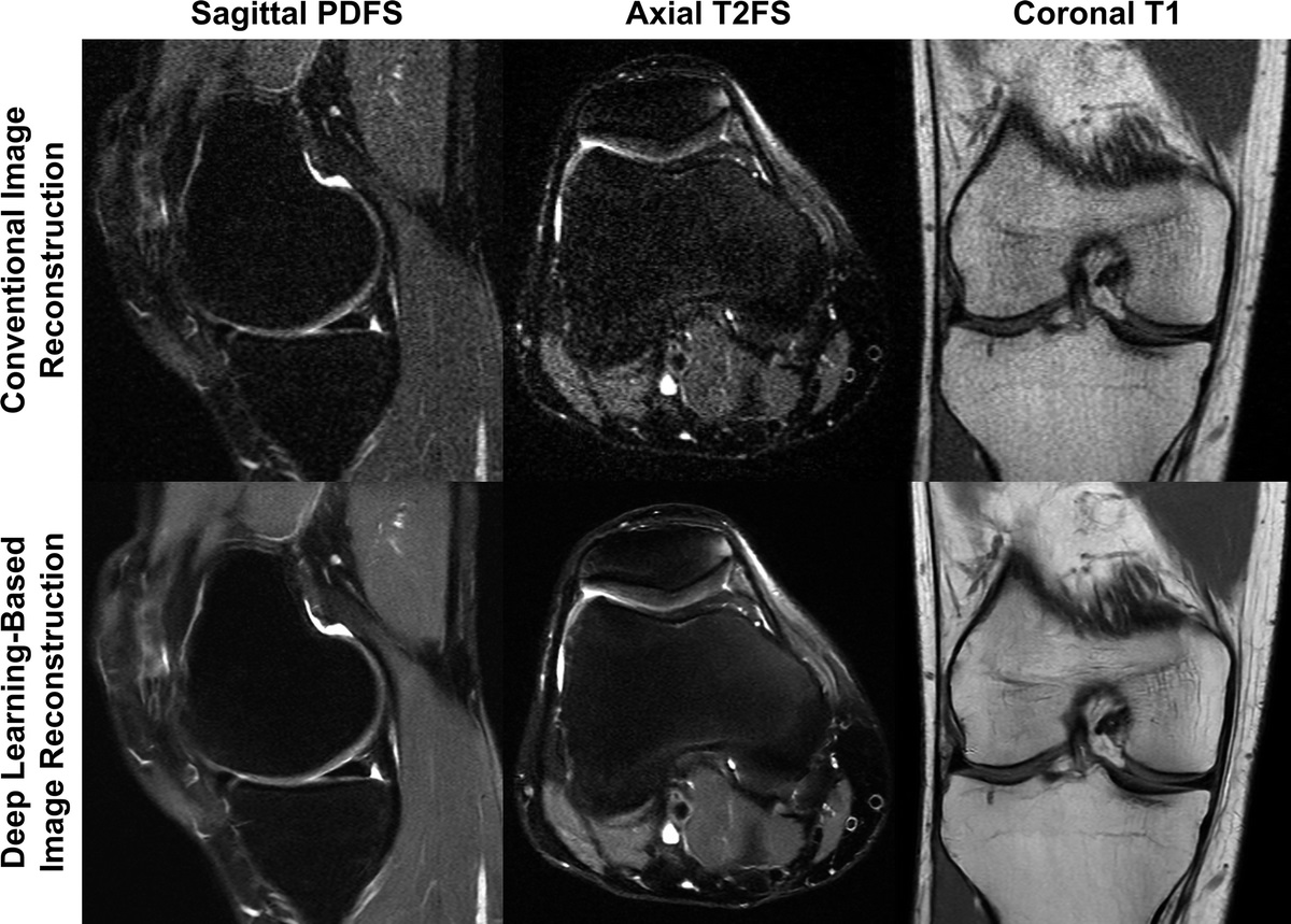 Modern Low-Field MRI of the Musculoskeletal System: Practice Considerations, Opportunities, and Challenges