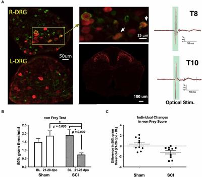 C-low threshold mechanoreceptor activation becomes sufficient to trigger affective pain in spinal cord-injured mice in association with increased respiratory rates