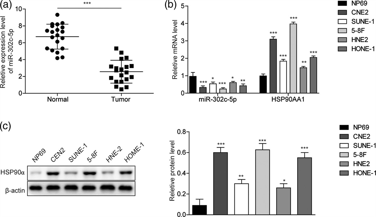 MiR-302c-5p affects the stemness and cisplatin resistance of nasopharyngeal carcinoma cells by regulating HSP90AA1