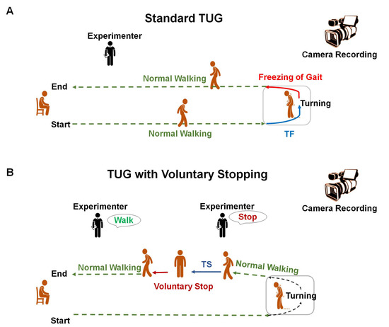 Applied Sciences, Vol. 13, Pages 302: Predicting the Onset of Freezing of Gait Using EEG Dynamics