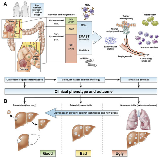 Cancers, Vol. 15, Pages 181: Histopathological Growth Pattern in Colorectal Liver Metastasis and The Tumor Immune Microenvironment