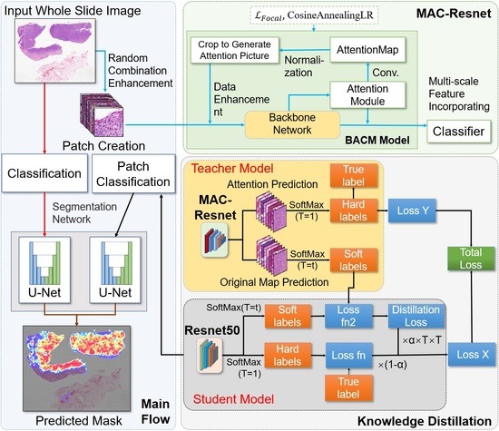 JPM, Vol. 13, Pages 89: MAC-ResNet: Knowledge Distillation Based Lightweight Multiscale-Attention-Crop-ResNet for Eyelid Tumors Detection and Classification