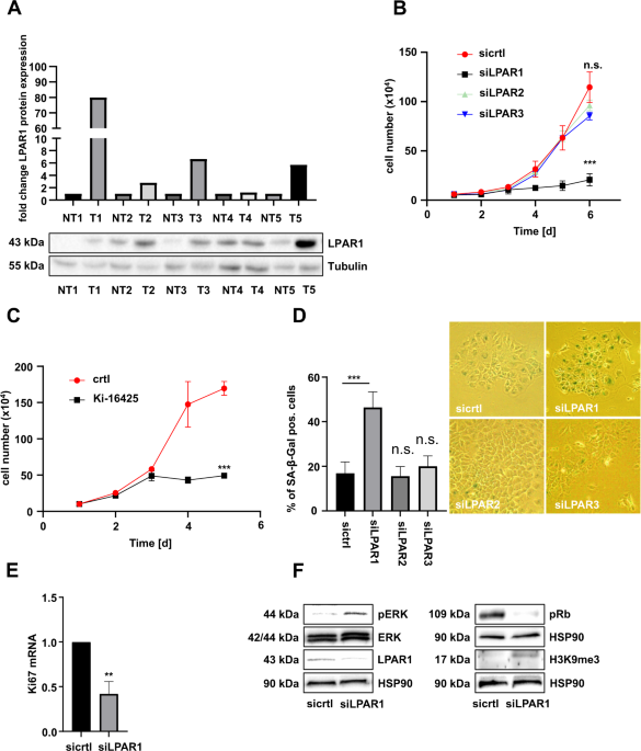 LPA receptor 1 (LPAR1) is a novel interaction partner of Filamin A that promotes Filamin A phosphorylation, MRTF-A transcriptional activity and oncogene-induced senescence
