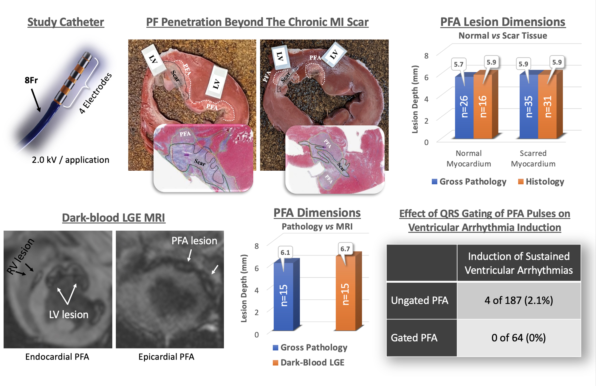 Electrophysiology, Pathology, and Imaging of Pulsed Field Ablation of Scarred and Healthy Ventricles in Swine