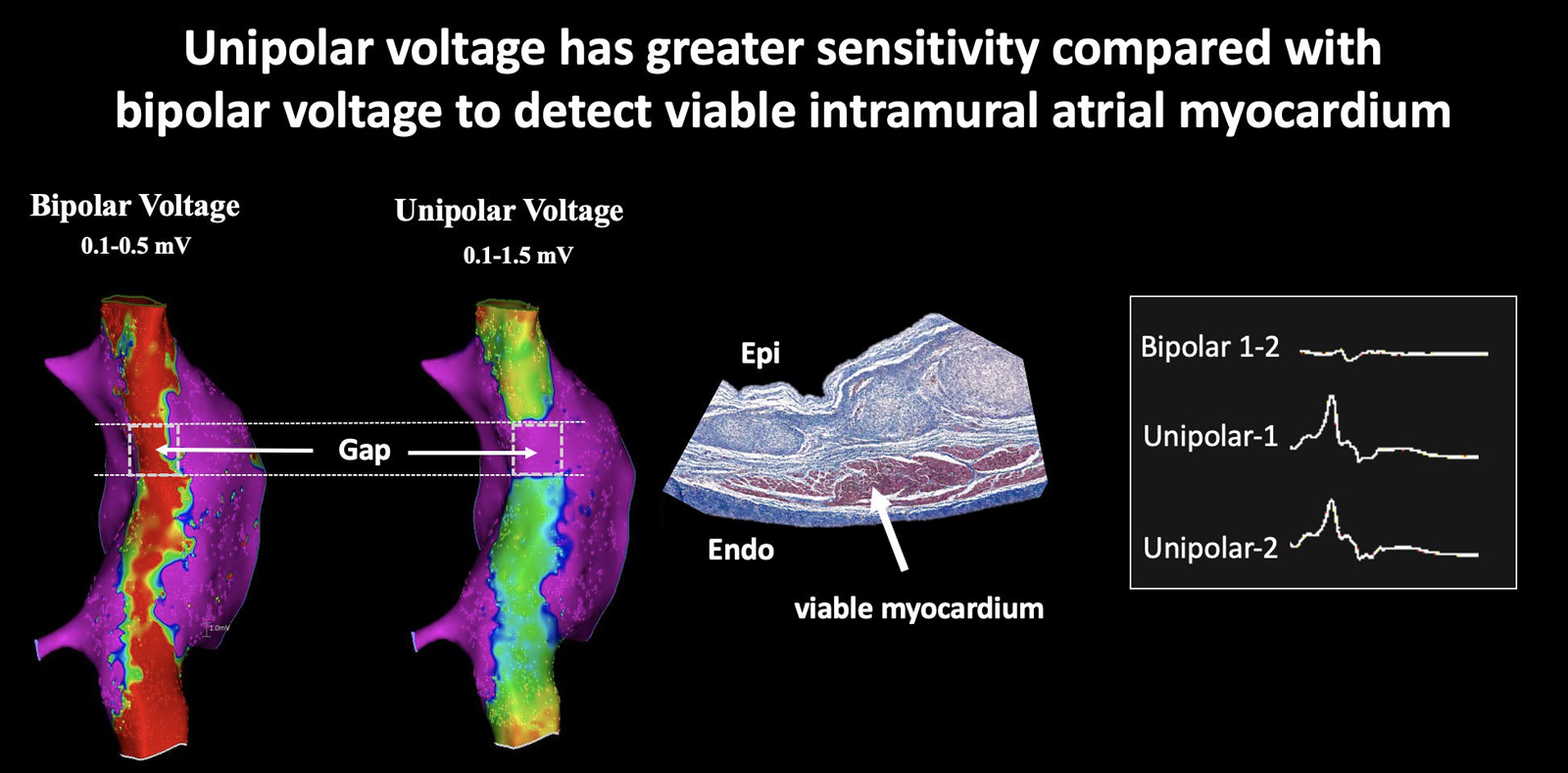 Atrial Endocardial Unipolar Voltage Mapping for Detection of Viable Intramural Myocardium: A Proof-of-Concept Study