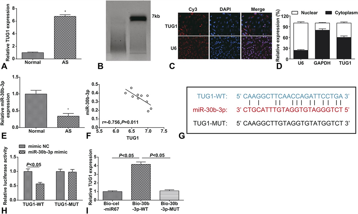 Silencing of Long Noncoding RNA TUG1 Ameliorates Atherosclerosis-Induced Myocardial Injury by Upregulating microRNA-30b-3p and Downregulating Brd4