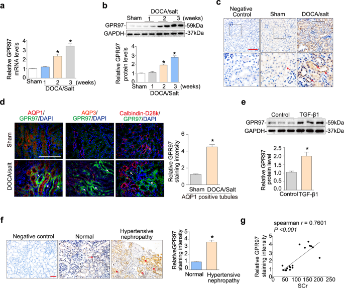 GPR97 deficiency ameliorates renal interstitial fibrosis in mouse hypertensive nephropathy