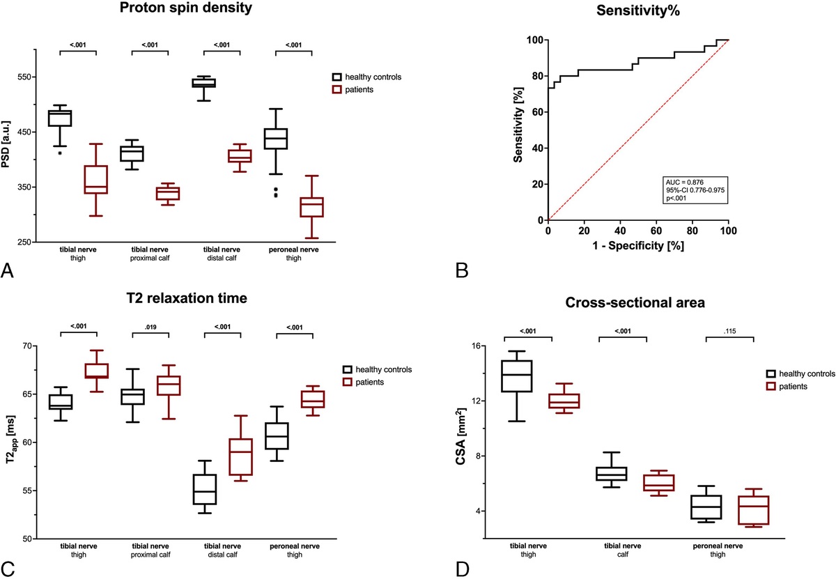 Peripheral Nerve Involvement at First Diagnosis of Multiple Sclerosis: A Prospective MR Neurography Study