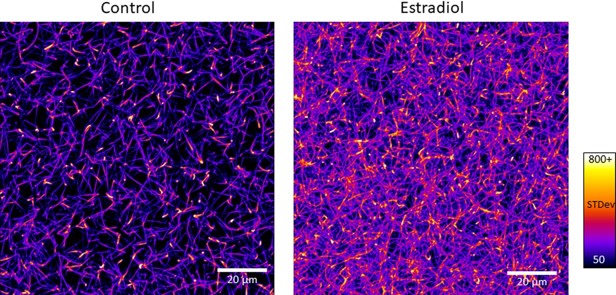 Estradiol provokes hypercoagulability and affects fibrin biology: A mechanistic exploration of sex dimorphisms in coagulation
