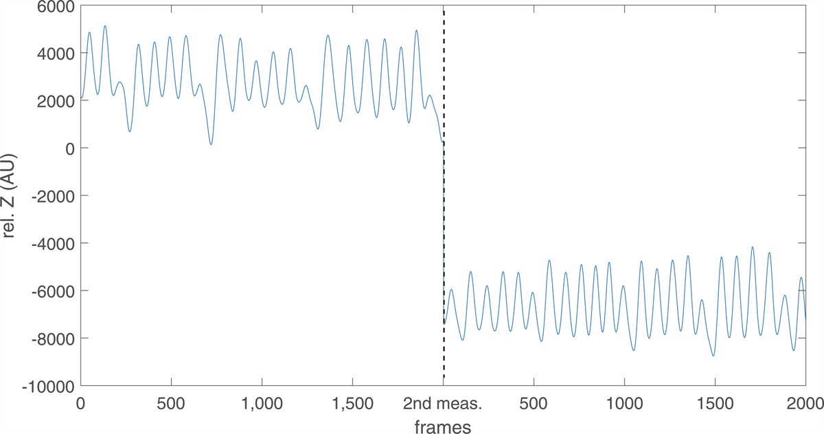 End-Expiratory Lung Impedance Measured With Electrical Impedance Tomography at Different Days Are Not Comparable