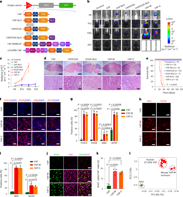 Nuclear condensates of YAP fusion proteins alter transcription to drive ependymoma tumourigenesis