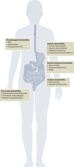 Systemic sclerosis gastrointestinal dysmotility: risk factors, pathophysiology, diagnosis and management