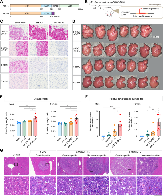 Androgen receptor variant 7 exacerbates hepatocarcinogenesis in a c-MYC-driven mouse HCC model