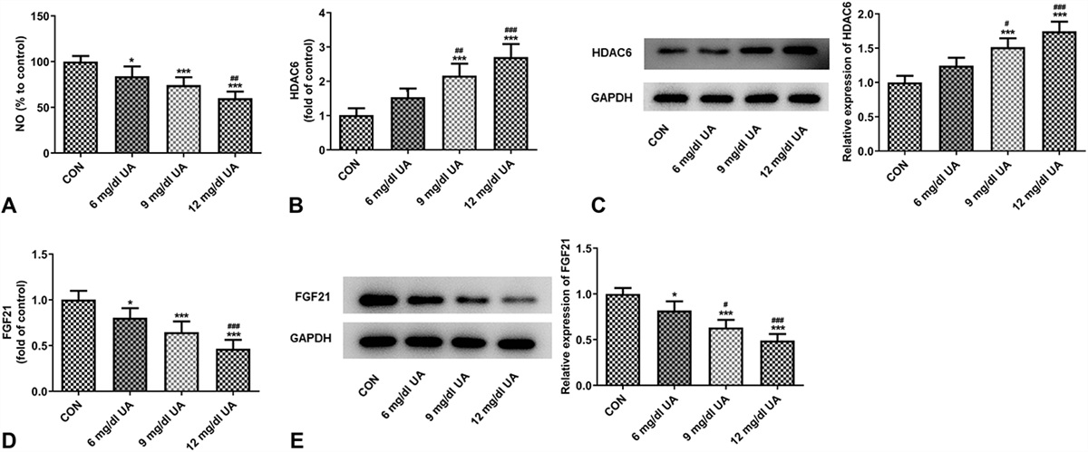 HDAC Inhibitors Alleviate Uric Acid–Induced Vascular Endothelial Cell Injury by Way of the HDAC6/FGF21/PI3K/AKT Pathway