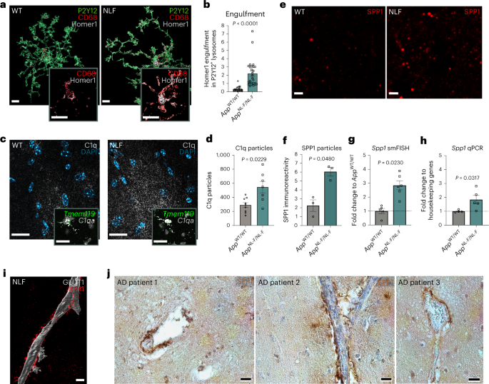 Perivascular cells induce microglial phagocytic states and synaptic engulfment via SPP1 in mouse models of Alzheimer’s disease
