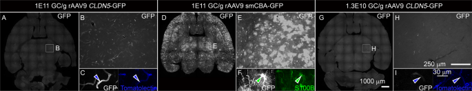 Sonoselective delivery using ultrasound and microbubbles combined with intravenous rAAV9 CLDN5-GFP does not increase endothelial gene expression