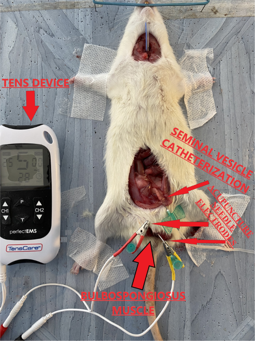 Low frequency neuromuscular electrical stimulation applied to the bulbospongiosus muscle prolongs the ejaculation latency in a rat model