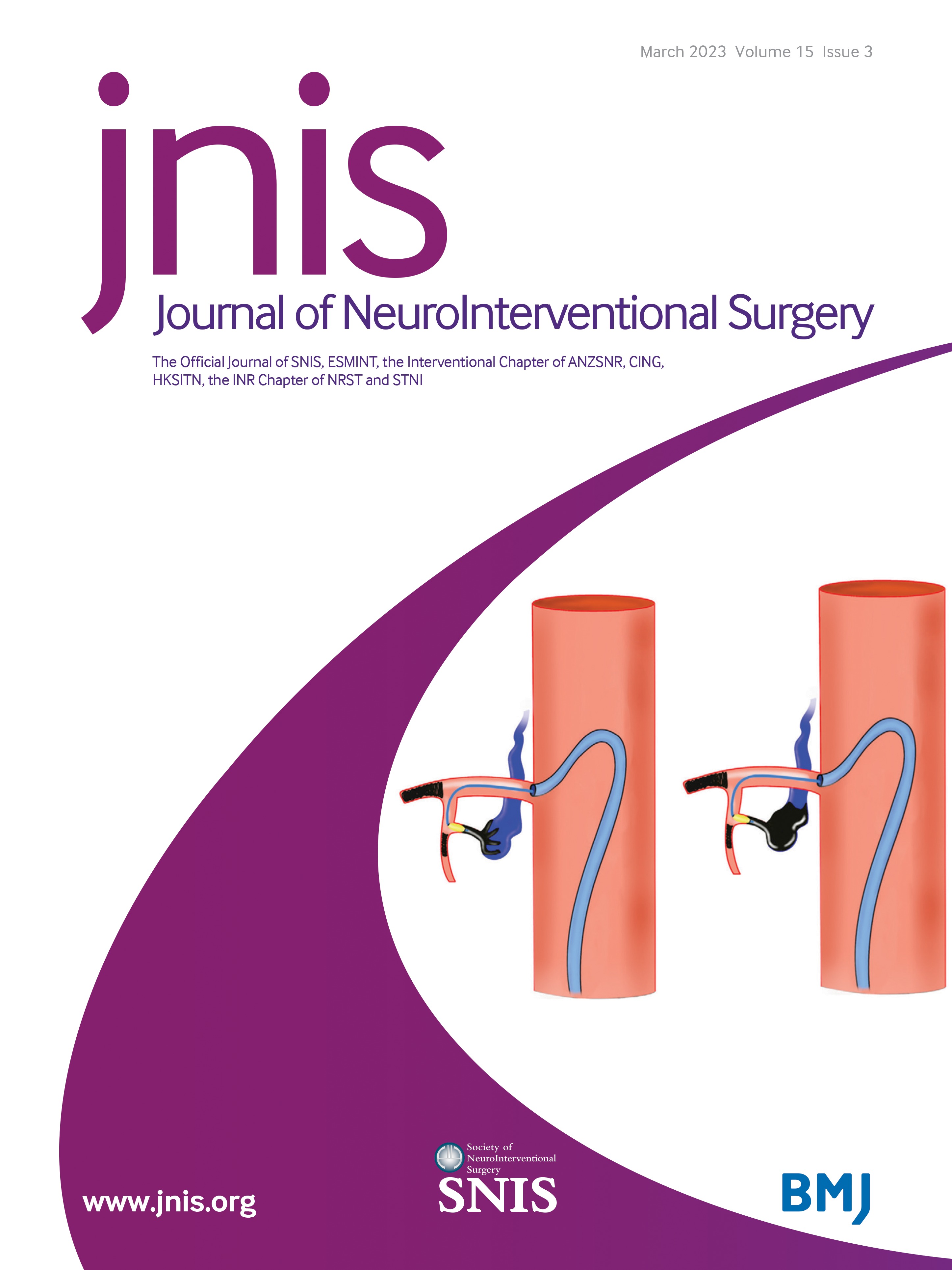 Stents for progressively symptomatic paediatric intracranial arterial dissection