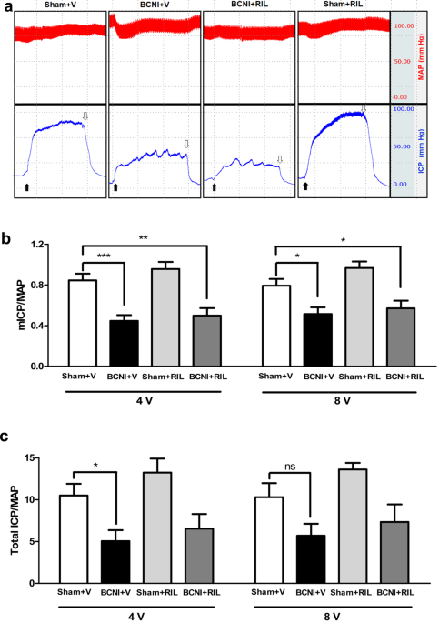 Riluzole, a neuroprotective agent, preserves erectile function following bilateral cavernous nerve injury in male rats