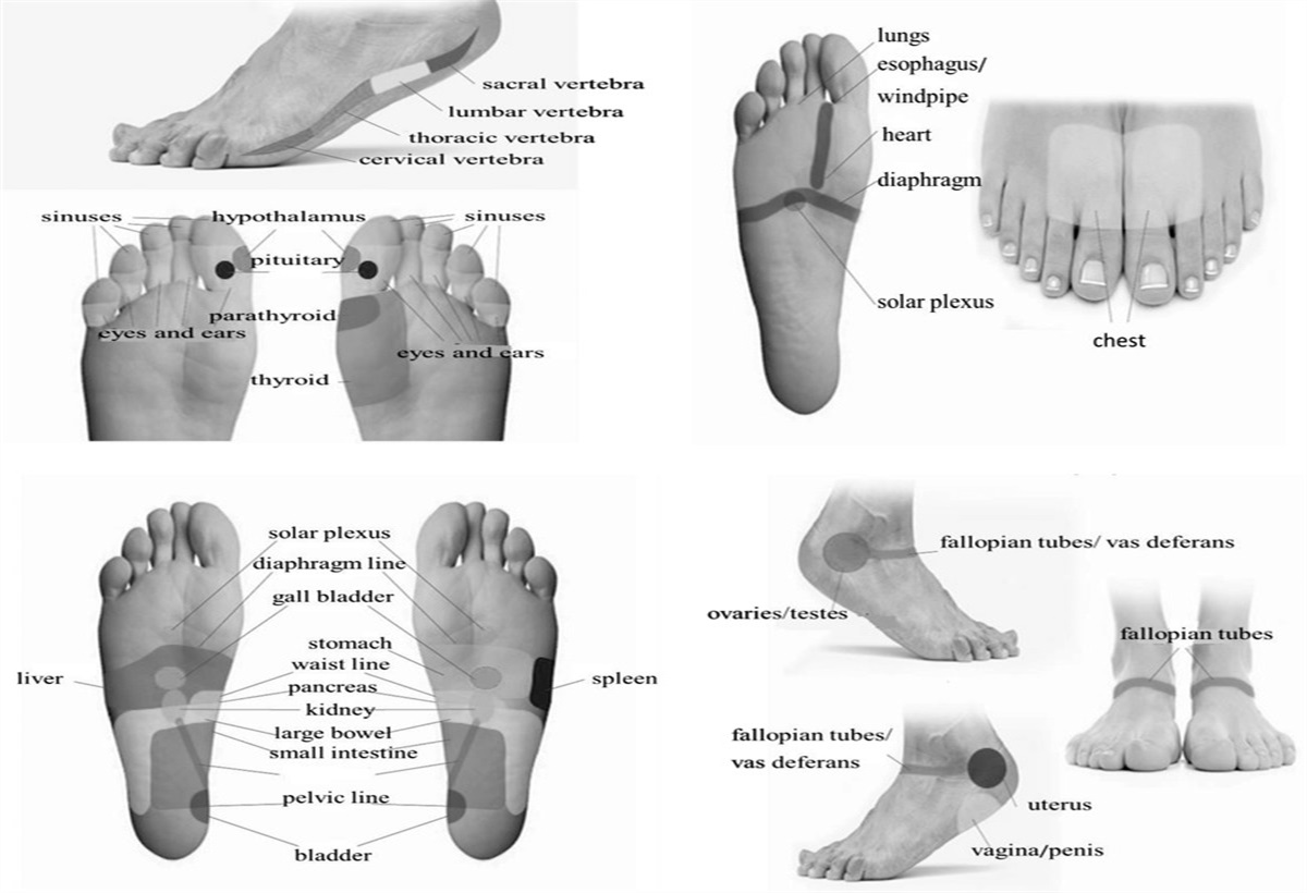 Effect of Reflexology on Decreasing Postoperative Pain and Anxiety After Total Abdominal Hysterectomy