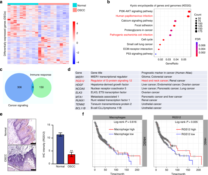 RGS12 represses oral squamous cell carcinoma by driving M1 polarization of tumor-associated macrophages via controlling ciliary MYCBP2/KIF2A signaling